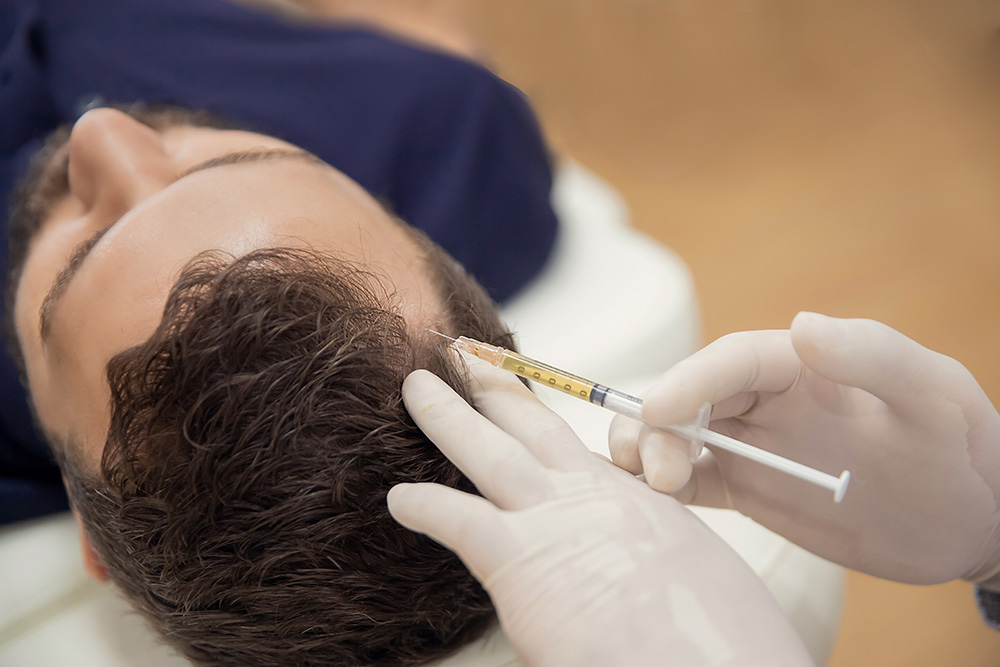 Transplantation ohne Rasur