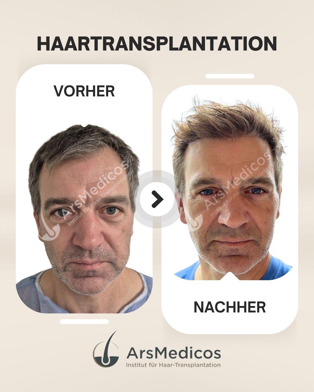 Vorher-Nachher-Beispiel-1