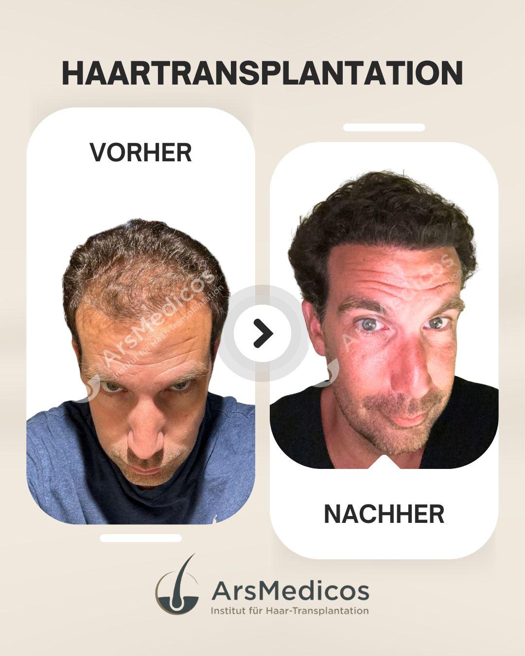 Vorher-Nachher-Beispiel-2