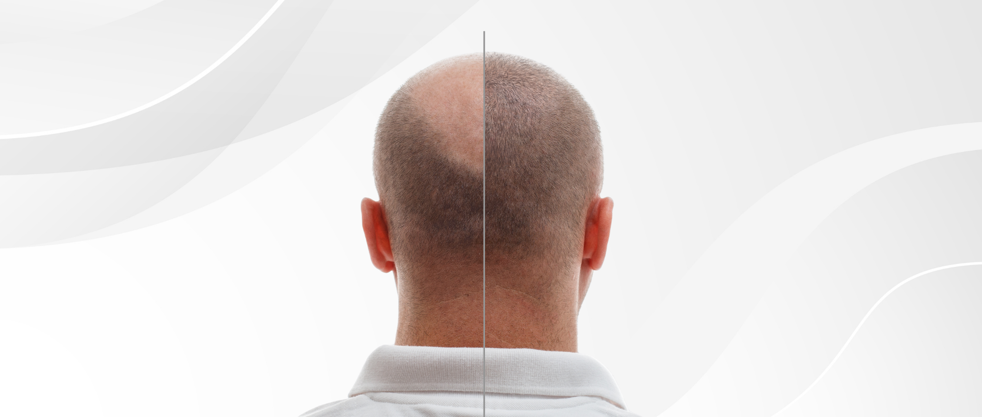 Vorher-Nachher-Beispiel