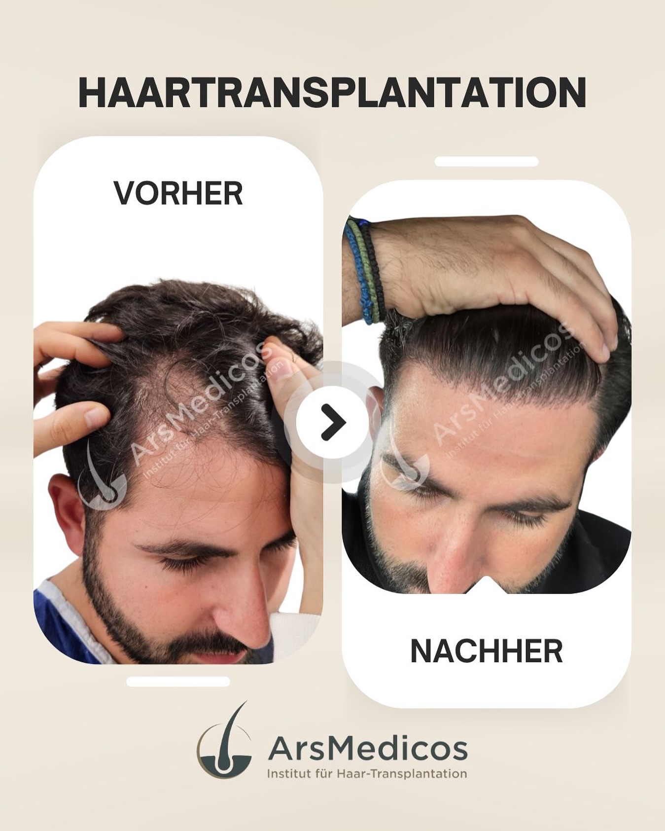 Vorher-Nachher-Beispiel-4 23.10.2025