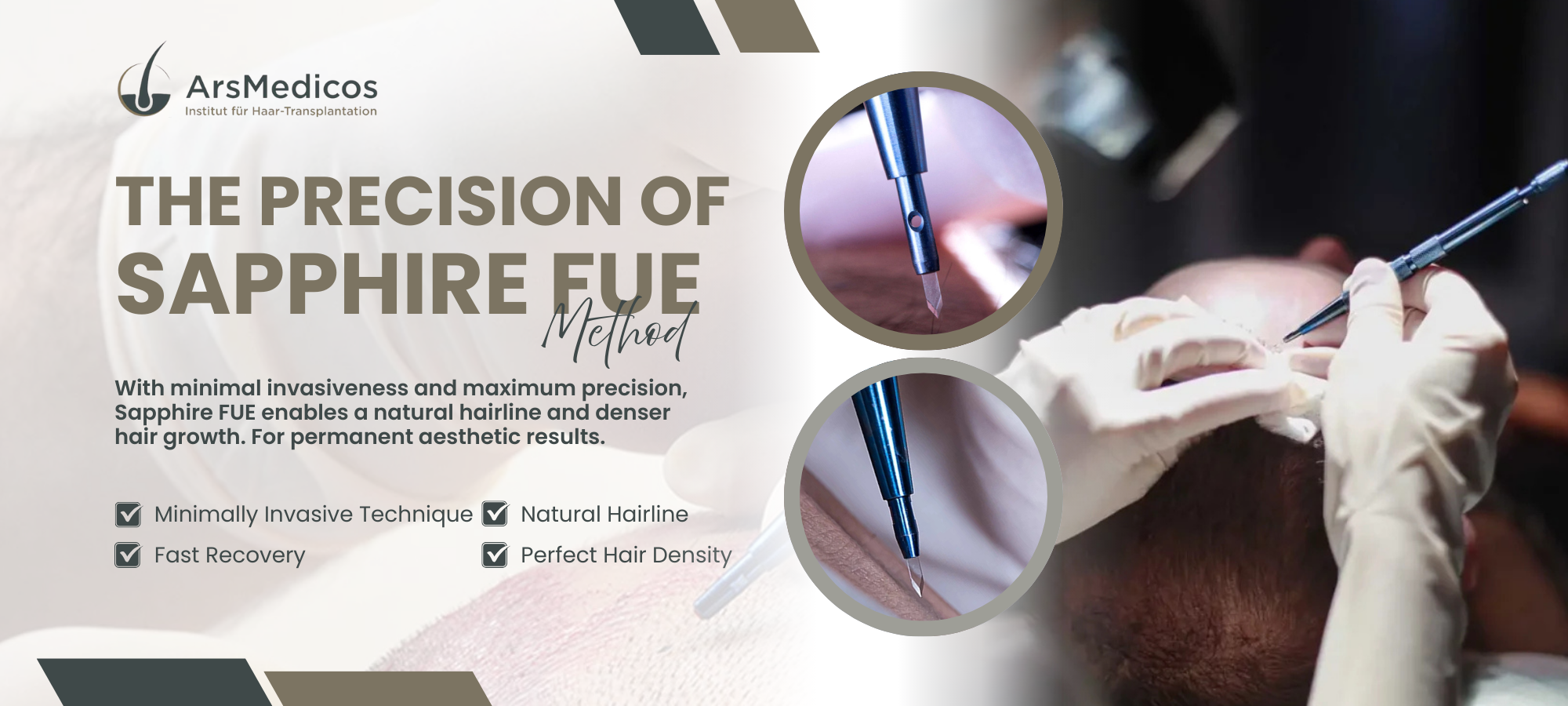 Ars Medi Cos Saphire-Fue-Method-N