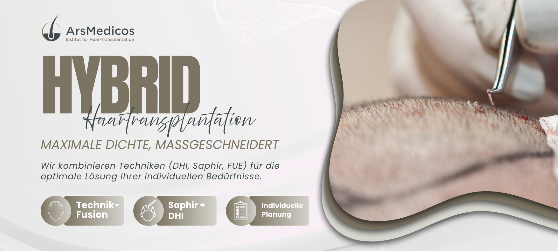 arsmedicos-hybrid-technik haartransplantation